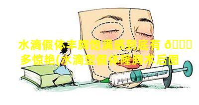 水滴假体丰胸饱满感到底有 🐋 多惊艳(水滴型假体隆胸术后图 💐 片)